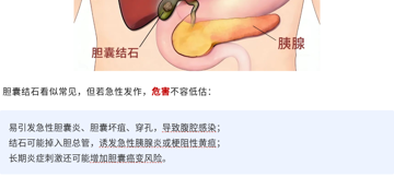 腹痛9天险丢命！我院外科团队成功救治急性结石性梗阻性胆囊炎患者