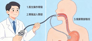 一文读懂胃镜检查：做胃镜到底有多难受？哪些人需要做？