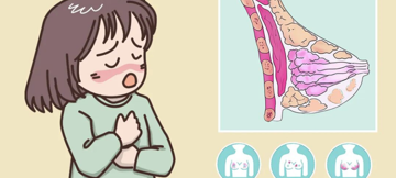 五十岁女子单侧乳头反复渗液，医生：这种乳腺癌，太容易被误诊！