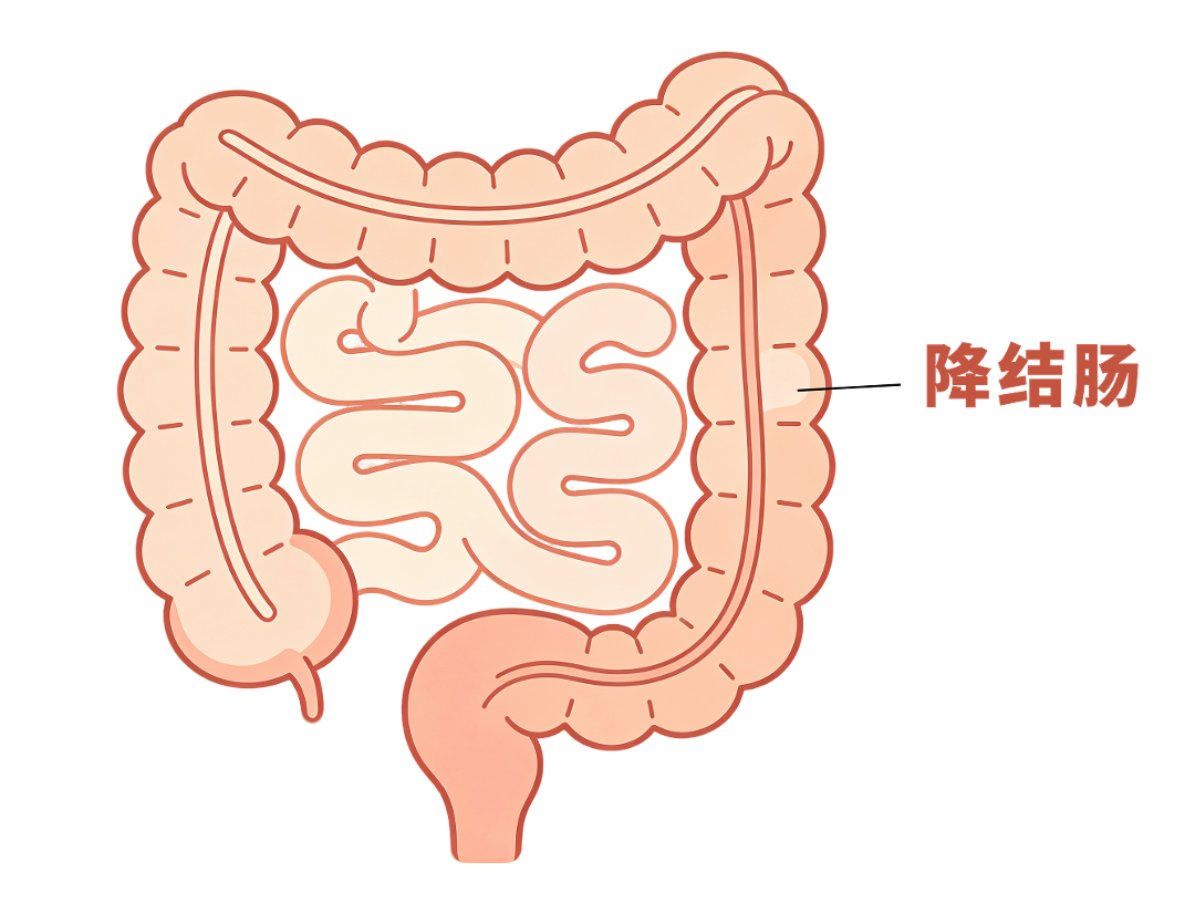 降结肠平面插画生成.png