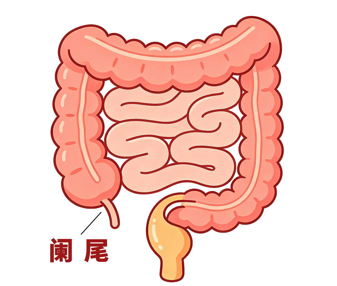 平面插画高位阑尾炎示意图 (1).png