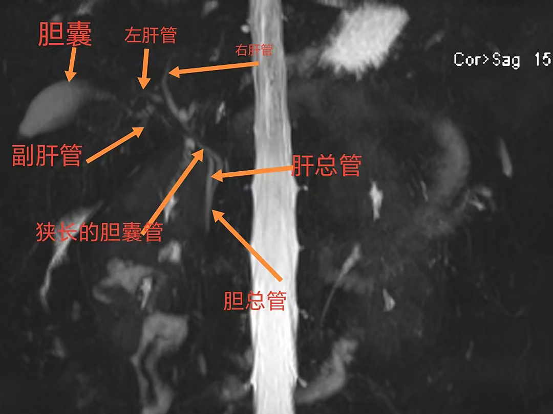 术前.jpg