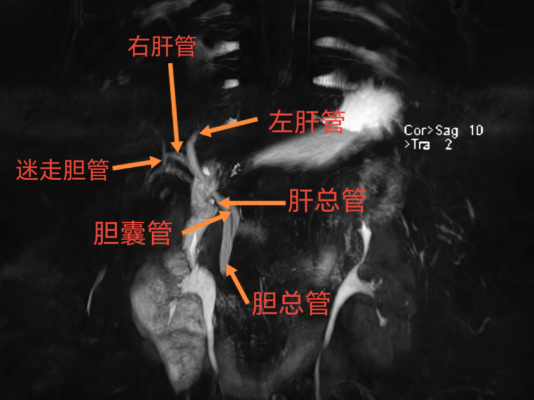 ec090c400f631fd1690f0baff6374e8.jpg